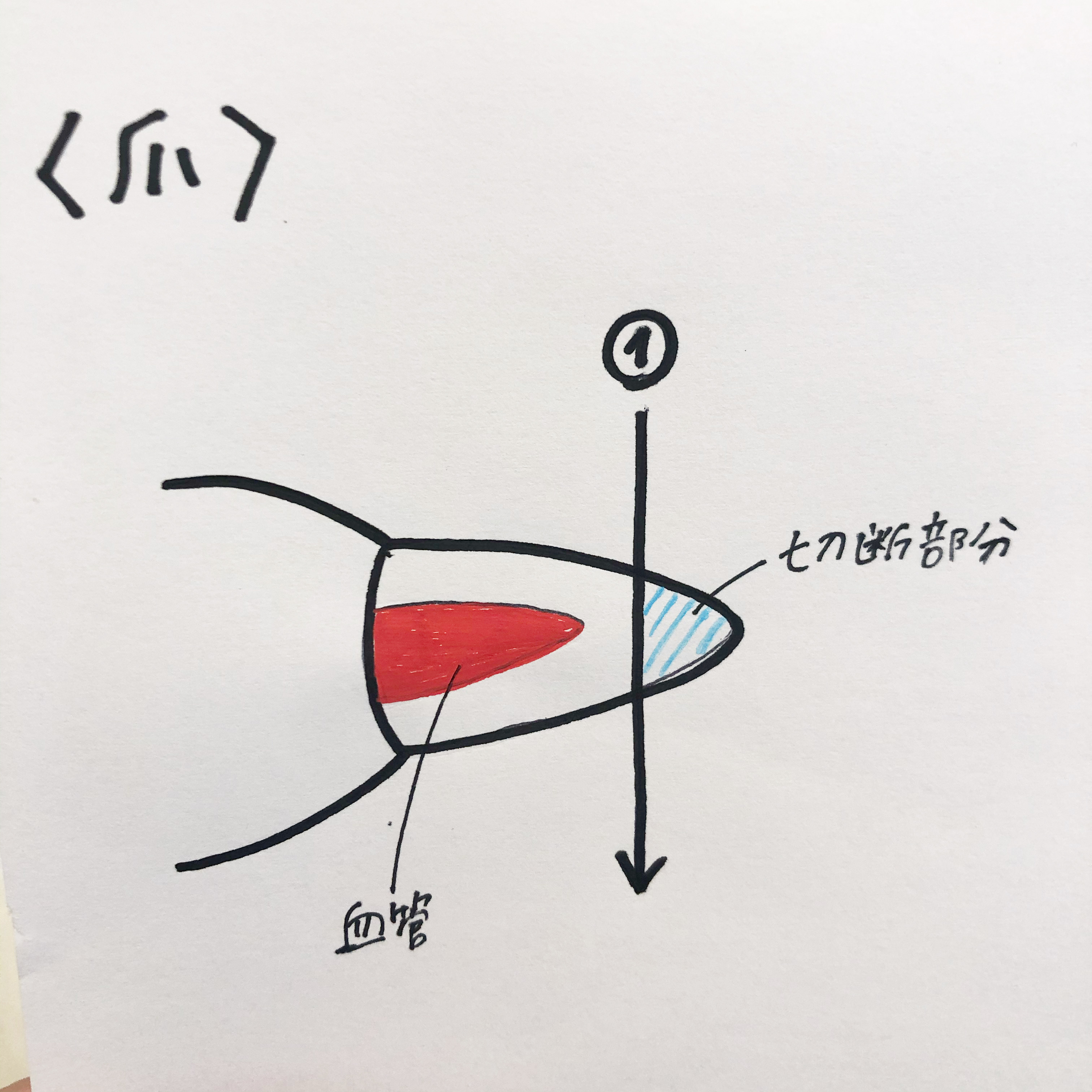 1 1