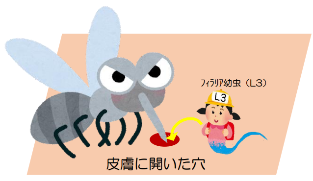 侵入