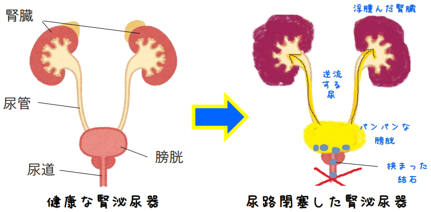尿閉