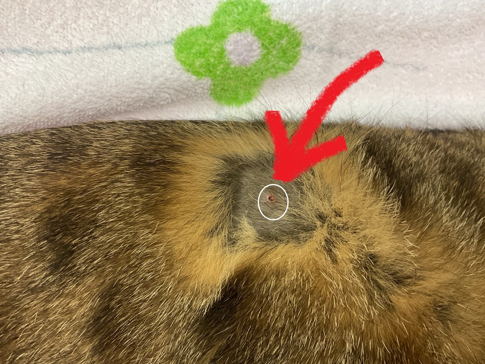 背中ポッチアップ